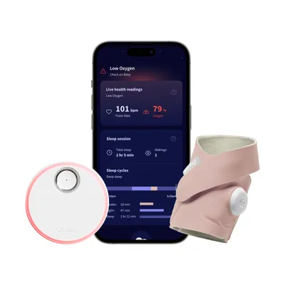 Owlet Inteligentes Babyphone - Dream Sock
